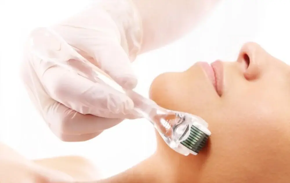 Microneedling
